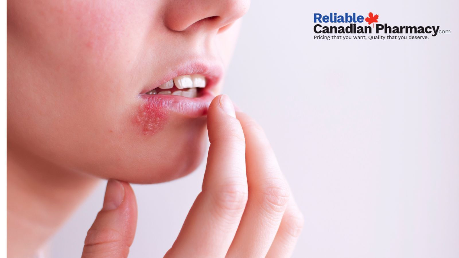 Valtrex 500mg Tablets Help Manage Herpes Infections