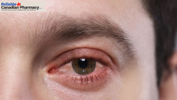Amoxil 250mg for Bacterial Infections: When Is It Prescribed?