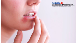 How do Valtrex 500mg Tablets Help Manage Herpes Infections? 
