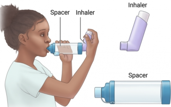 Spacer for Inhaler